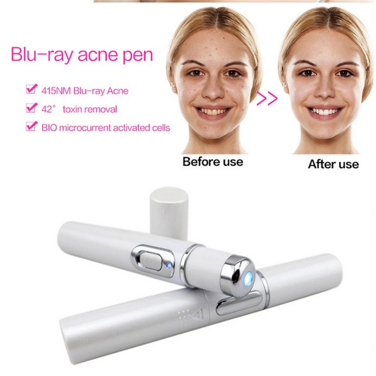 Acne Laser Pen Soft Scar Wrinkle Removal