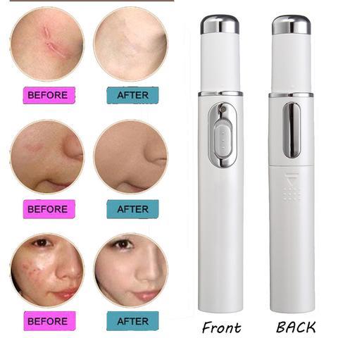 Acne Laser Pen Soft Scar Wrinkle Removal